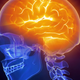 Image for article titled What cannabis actually does to your brain